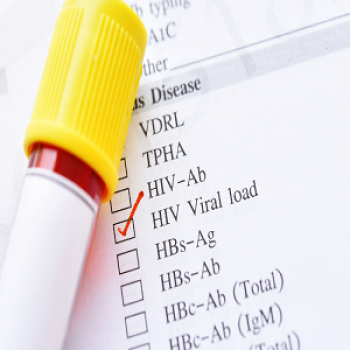 HIV 1 RNA PCR VIRAL LOAD