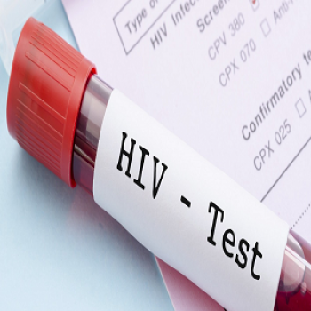 HIV 