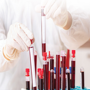 DNA Paternity Testing (Postnatal)